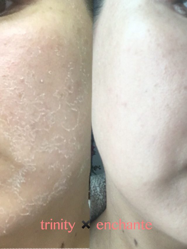 Read more about the article 【30代前半】ヴェリテ4日間 ✖️ ハーブ3g